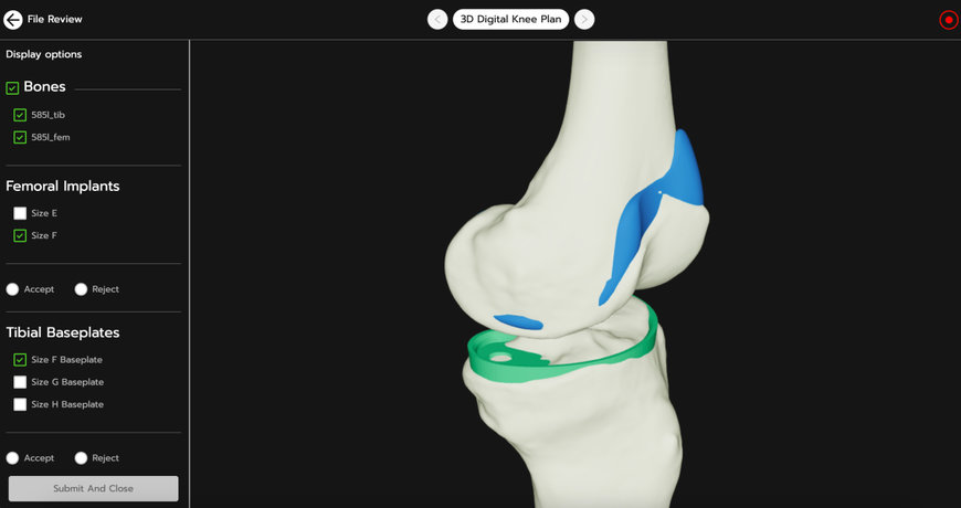 3D SYSTEMS INTRODUCES CLOUD-BASED SURGICAL PLANNING PORTAL